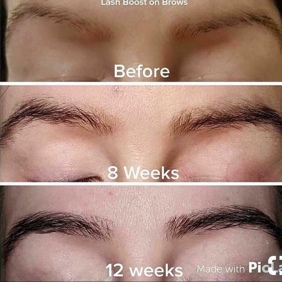 Eye lash growth and eyebrow growth serum - Picture 5 of 5